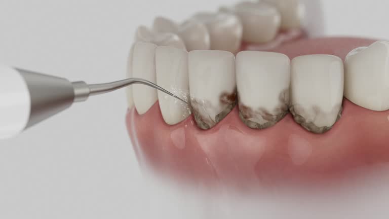 Reliable Dental Implants contractor in Fuller Heights, FL by Smile Center Dentistry